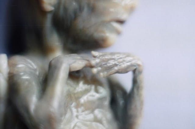 This child was aborted at 18 weeks gestation using the saline abortion method – note the burned skin. (Images courtesy of ProLifeSociety.com and ImagesOfAbortion.com) If we are mourning miscarried babies, we should be mourning aborted babies too image