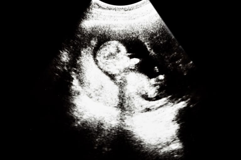 ultrasounds-baby-1