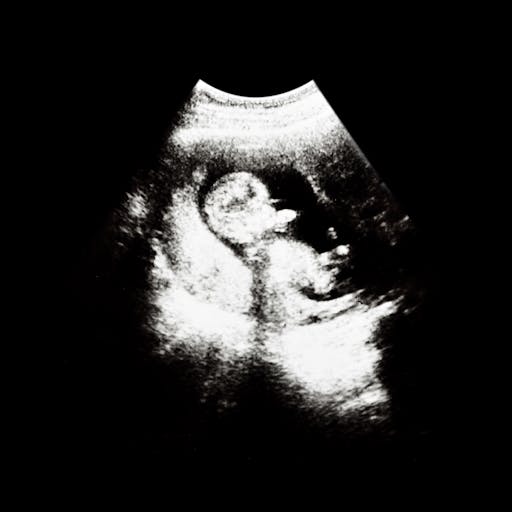 ultrasounds-baby-1