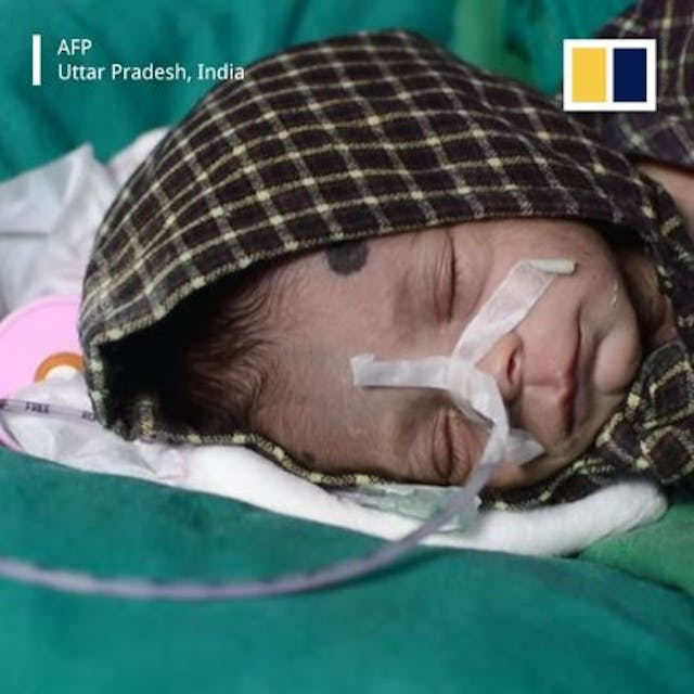 Screenshot. Newborn baby found alive in India by man digging grave for his own child image