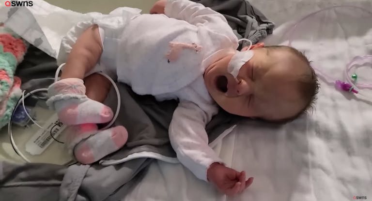 spina bifida