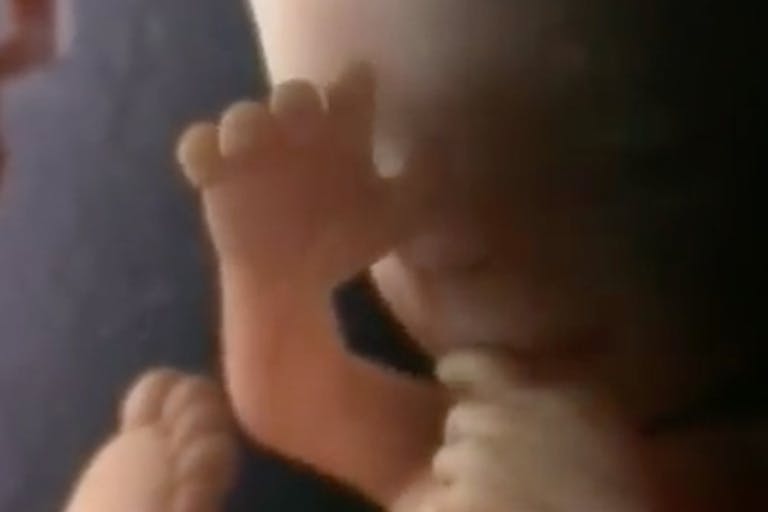 fetus-prenatal