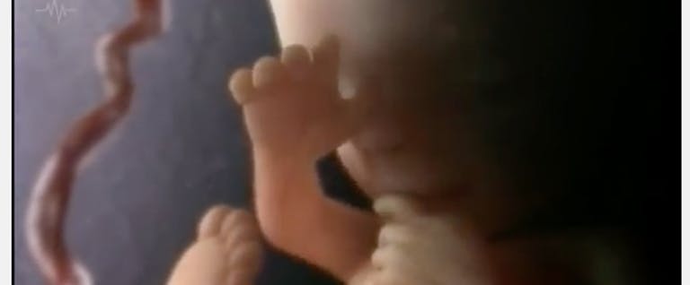 fetus-prenatal