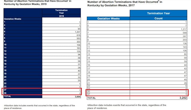 KY abortion up to birth 35 to 37 weeks gestation Kentucky 2019 and 2017 Image: KY babies aborted up to the day of birth at 35 to 37 weeks gestation Kentucky 2019 and 2017
