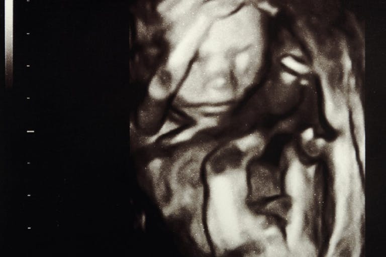 dreamstime_m_17402568