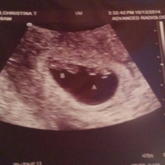 Christopher and Eli Byrum. (Photo courtesy of Facebook.) Christopher and Eli Byrum. Photo courtesy of Facebook.