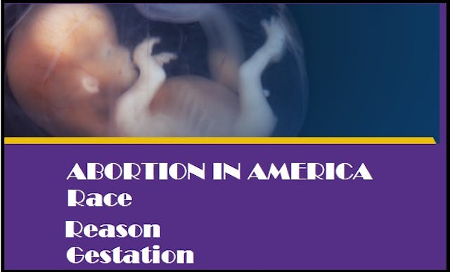 Abortion stats in USA race gestation reason Image: Abortion stats in USA race gestation reason