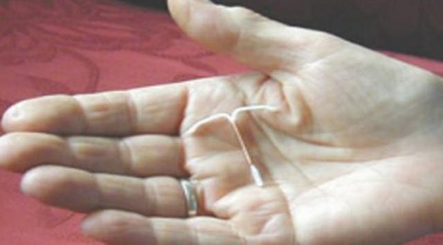 IUD, abortion, abortifacient, birth control