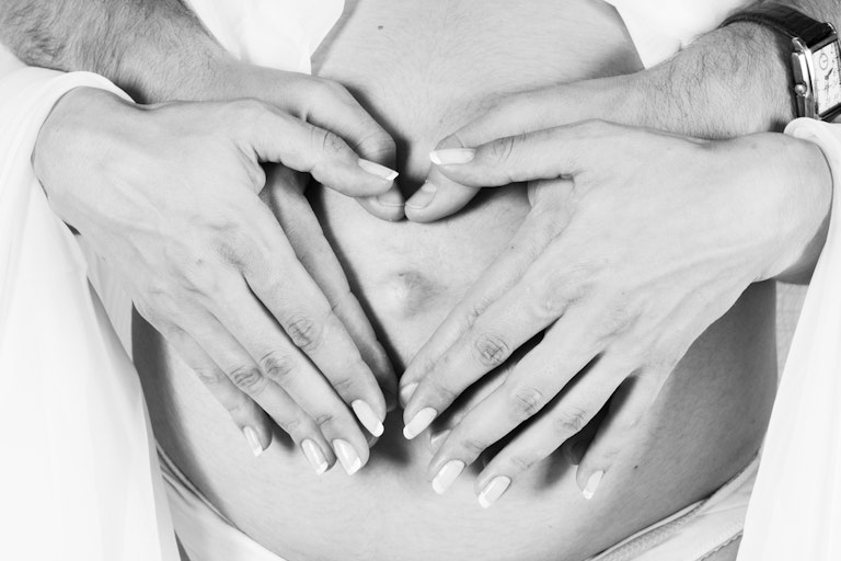 anencephaly