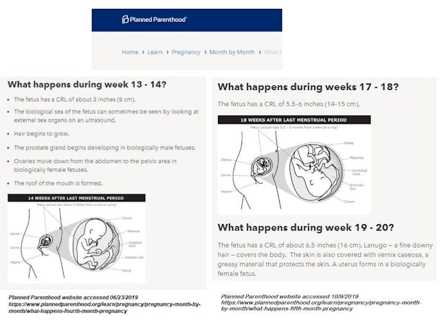Image: Planned Parenthood fetal development at 13-14 and 17-20 weeks (Image: PPFA)