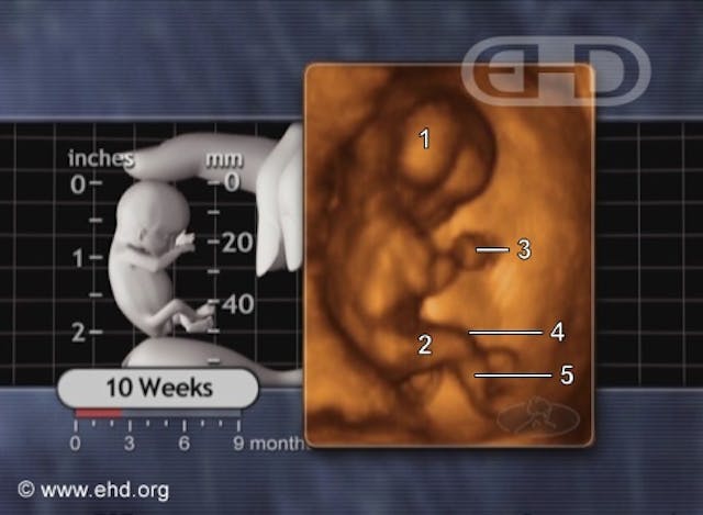 Photo: 10 weeks the-1-week-fetus