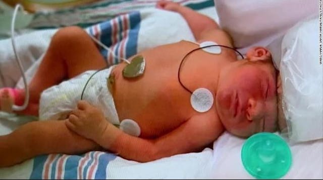 Baby Lucas in the hospital. Screenshot WABC. die at birth
