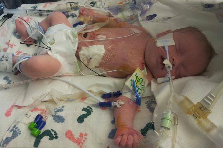 Easton after surgery