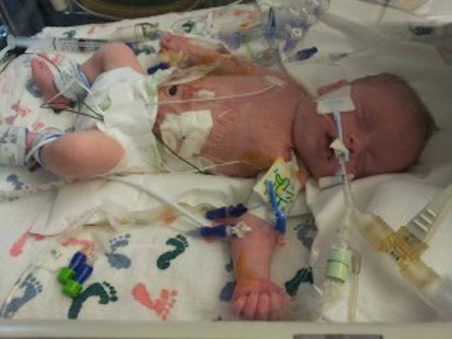 Easton, just a few weeks old, after surgery. Easton, just a few weeks old, after surgery.