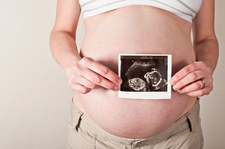 womb-ultrasound-standard