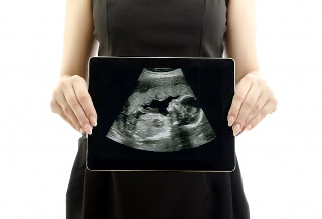 ultrasound
