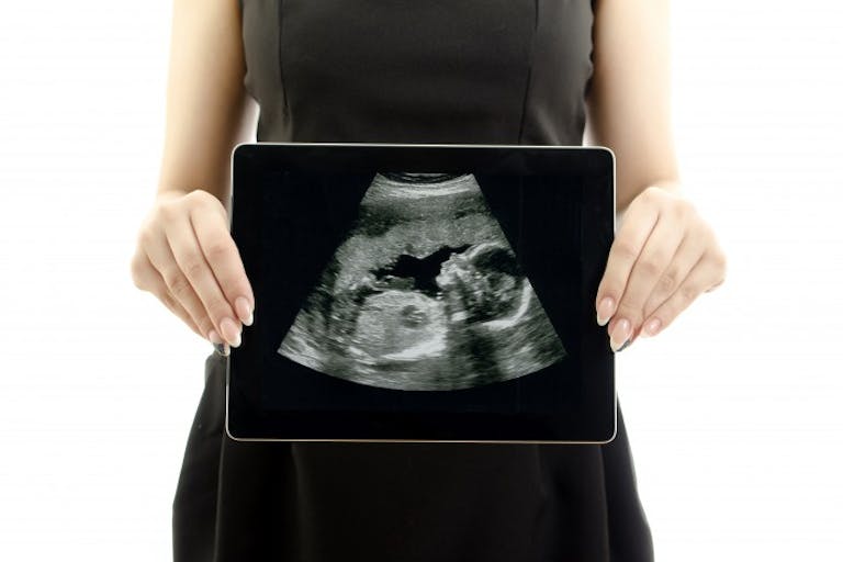 ultrasound