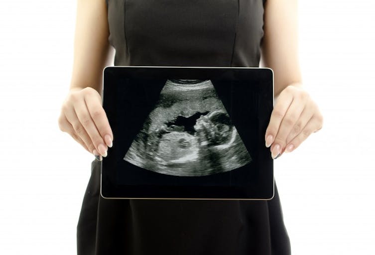 ultrasound
