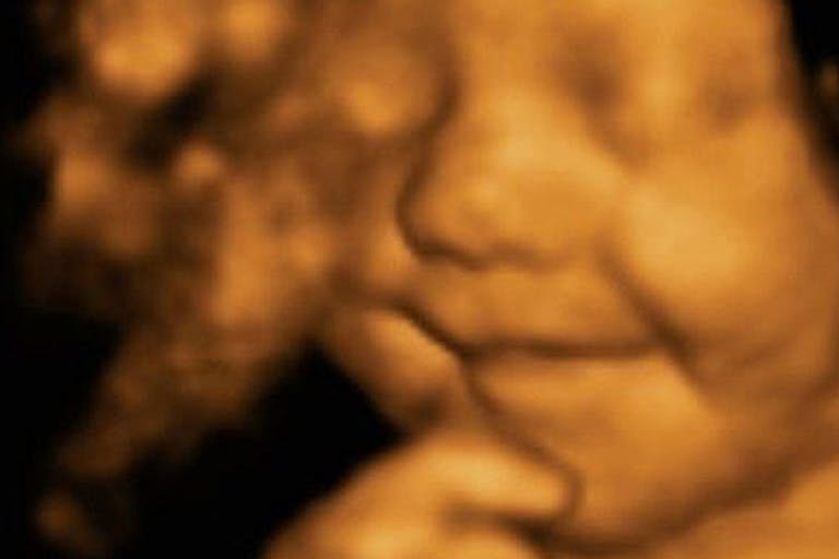 PX1Leo-scan_3106899b