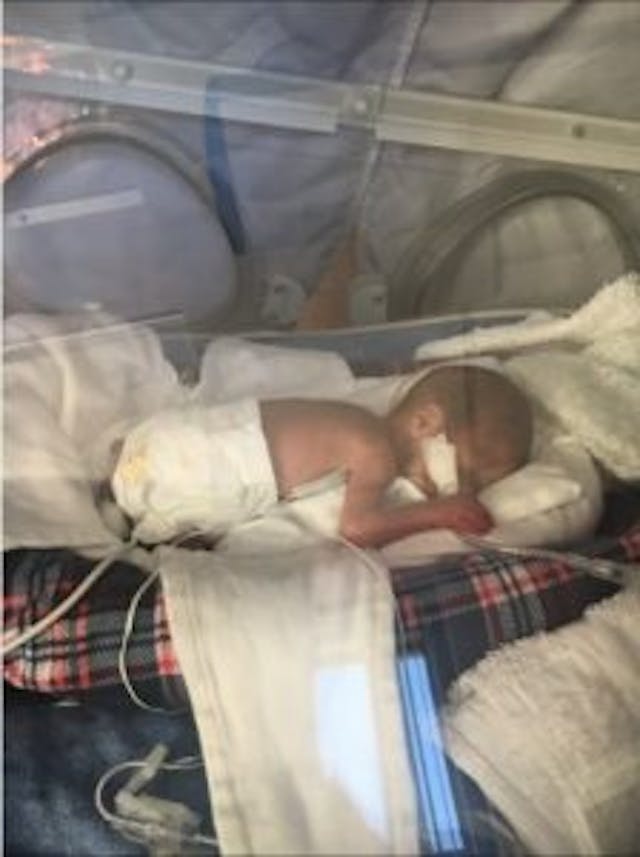 Rayden shortly after birth. Photo via YouCaring. Photo from You Caring.