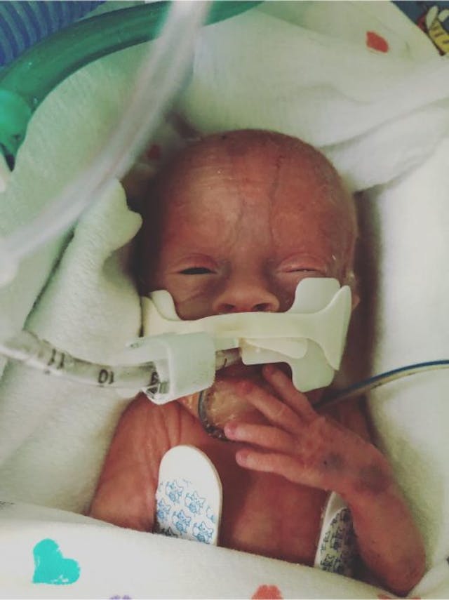 Photo via Facebook. preemie