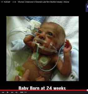 Preemie, premature, baby born at 24 weeks