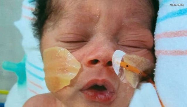 Baby Jackson. Screenshot Inside Edition. NICU adoption