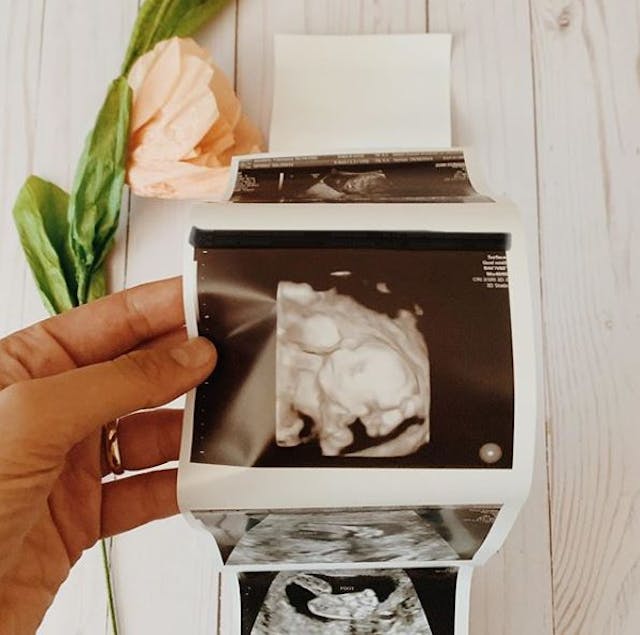 Battistelli’s Instagram photo. battistelli