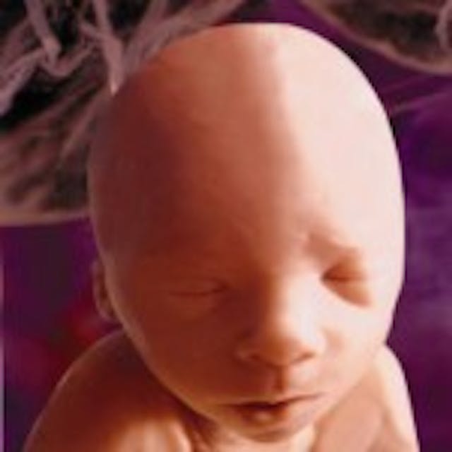 24 weeks