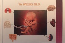 baby, body, heart, Orange County Fetal Parts 9