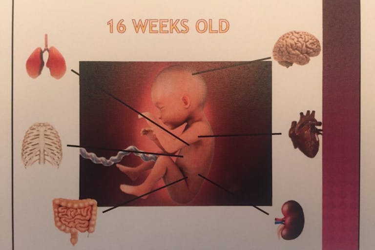 baby, body, heart, Orange County Fetal Parts 9