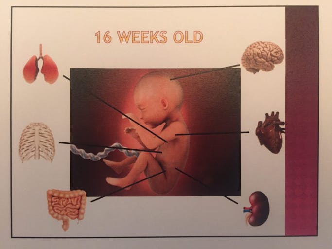baby, body, heart, Orange County Fetal Parts 9
