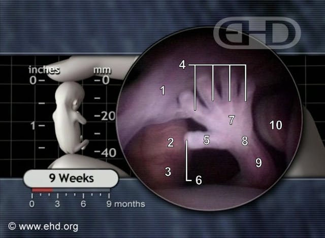 Lied to by abortion workers, she later learned the truth: ‘Why wouldn’t that nurse let me see my baby?’ image