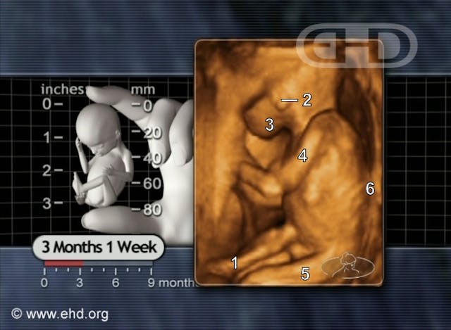 Lied to by abortion workers, she later learned the truth: ‘Why wouldn’t that nurse let me see my baby?’ image