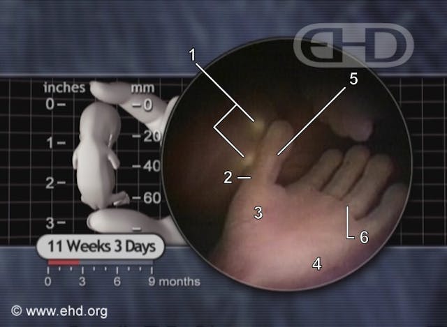 Lied to by abortion workers, she later learned the truth: ‘Why wouldn’t that nurse let me see my baby?’ image