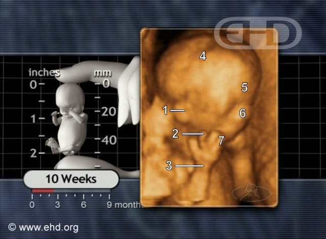 Lied to by abortion workers, she later learned the truth: ‘Why wouldn’t that nurse let me see my baby?’ image