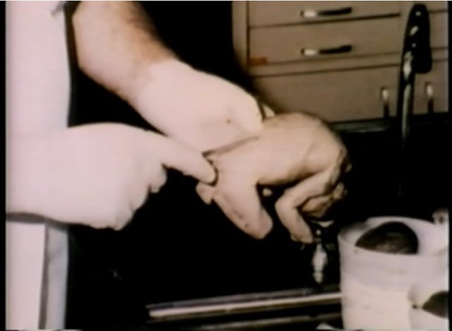 Image: Autopsy picture of aborted babies found in LA storage container