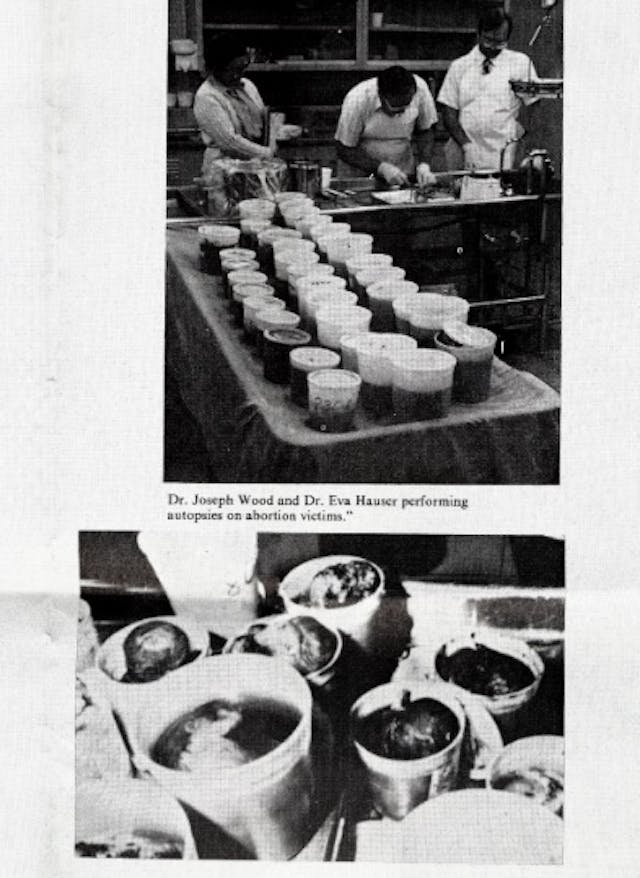 Autopsies on aborted babies found in storage container Image: Autopsies on aborted babies found in storage container