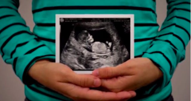 roe turns 41, ultrasound, mother