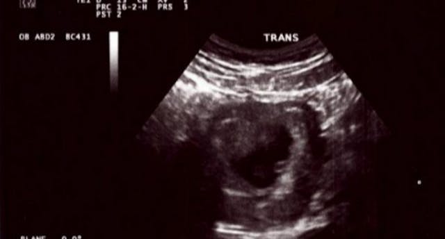 screen-shot-2016-10-04-at-3-46-11-pm