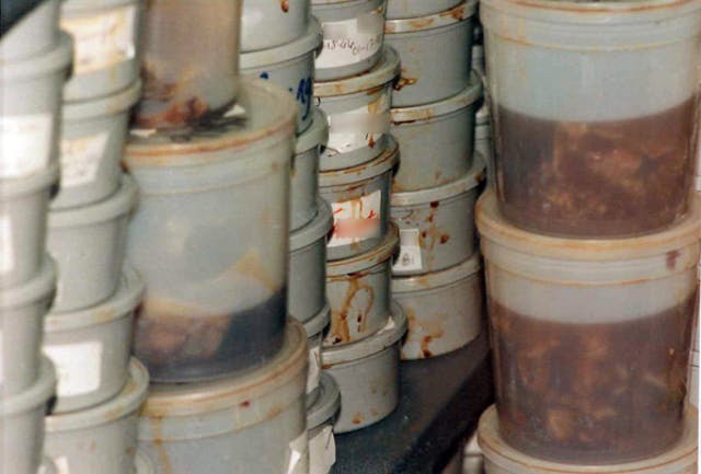 Path lab holds aborted babies in container (Image: Cal-Catholic) Image: Path lab holds aborted babies in container (Image: Cal-Catholic)