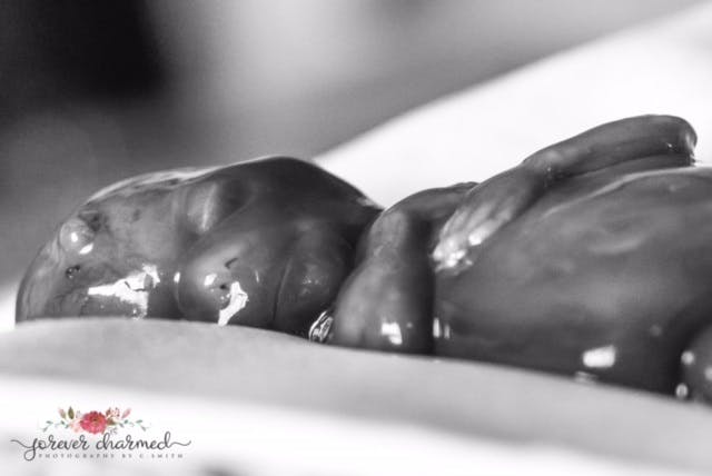 17-week-preborn-girl-4