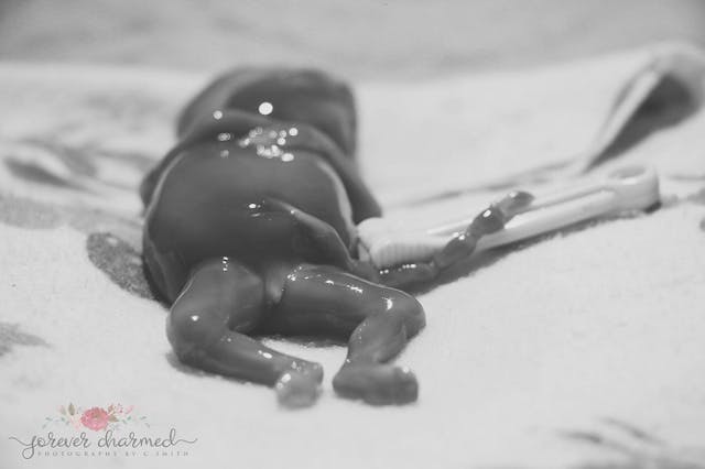 17-week-preborn-girl-3
