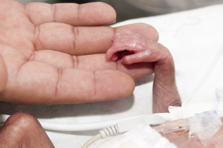 What does Planned Parenthood of the Rocky Mountains do with babies like this one — and why are we aborting them at all? What does Planned Parenthood of the Rocky Mountains do with these babies -- and why are we aborting them at all?
