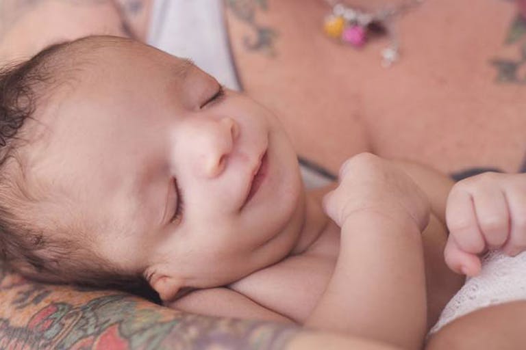 collins-treacher-syndrome