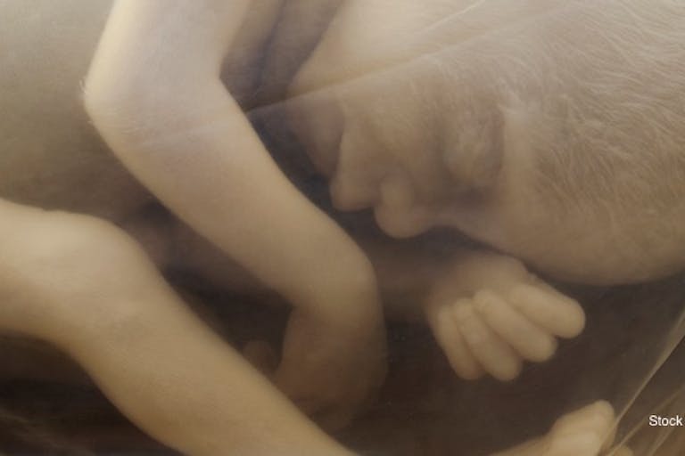 20-week-old-baby-in-utero-preborn