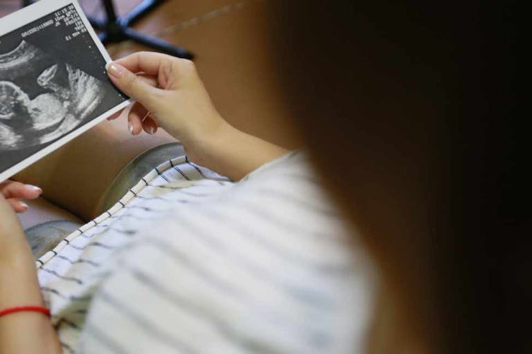 pregnant, rape, prenatal diagnosis