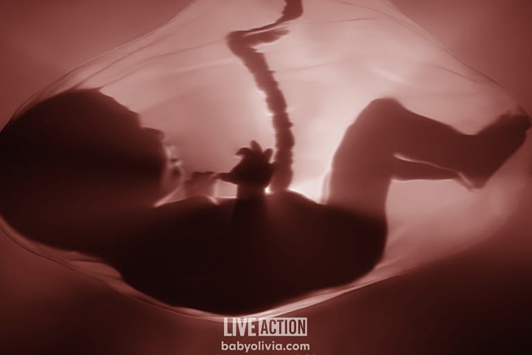 18 weeks post fertilization, 20 weeks LMP/gestation