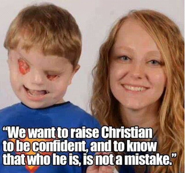 Christian Buchanan with his mother Lacey. He wasn't a typical newborn, but he has always been equally valuable. Christian's story has gone viral, thanks to a YouTube video his mother made.