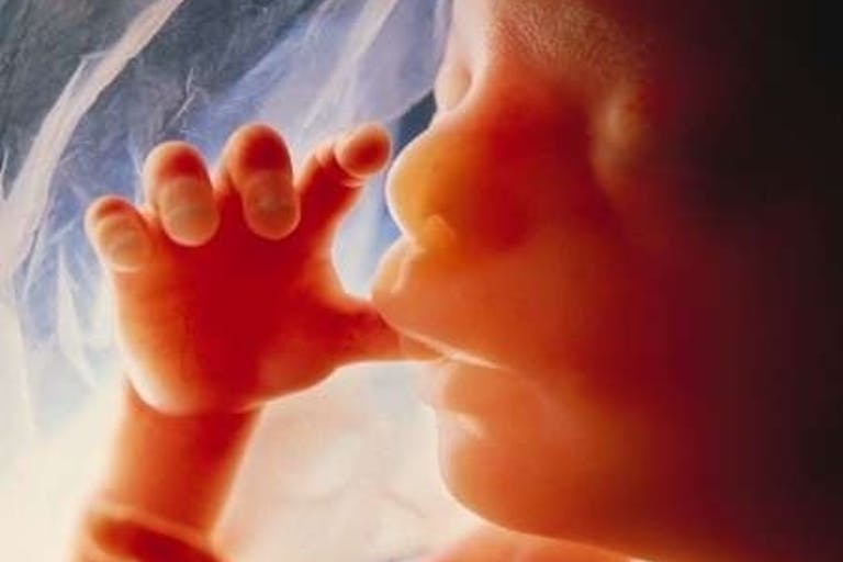 brainwreck.com_38954_1398991170